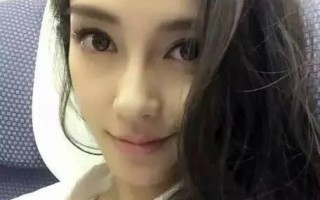 戴美瞳眼睛发炎怎么办，戴美瞳眼睛发炎怎么办没有眼药水怎么办